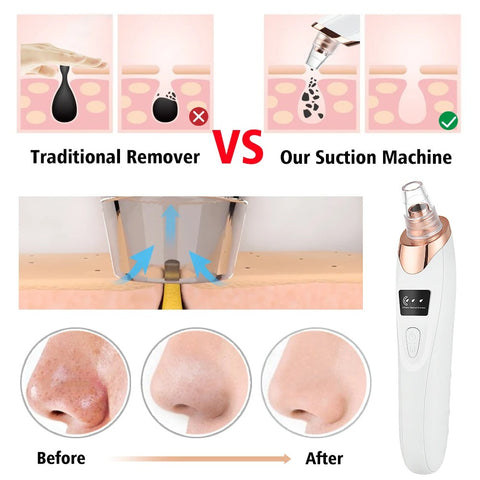 Blackhead Remover  Face Deep Cleansing