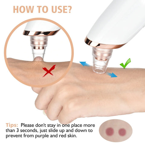 Blackhead Remover  Face Deep Cleansing